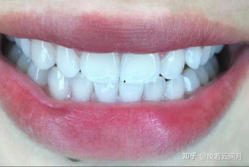 网红琥牙是那里人,揭秘其独特魅力背后的家乡故事